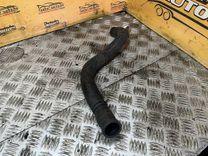 Патрубок радиатора TG5M29 Renault Scenic