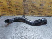 Патрубок воздушного фильтра XYNGRU Citroen C5 - Фото 2